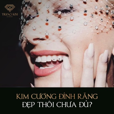 Mua Kim Cương Đính Răng ở đâu? - Đẹp thôi chưa đủ!